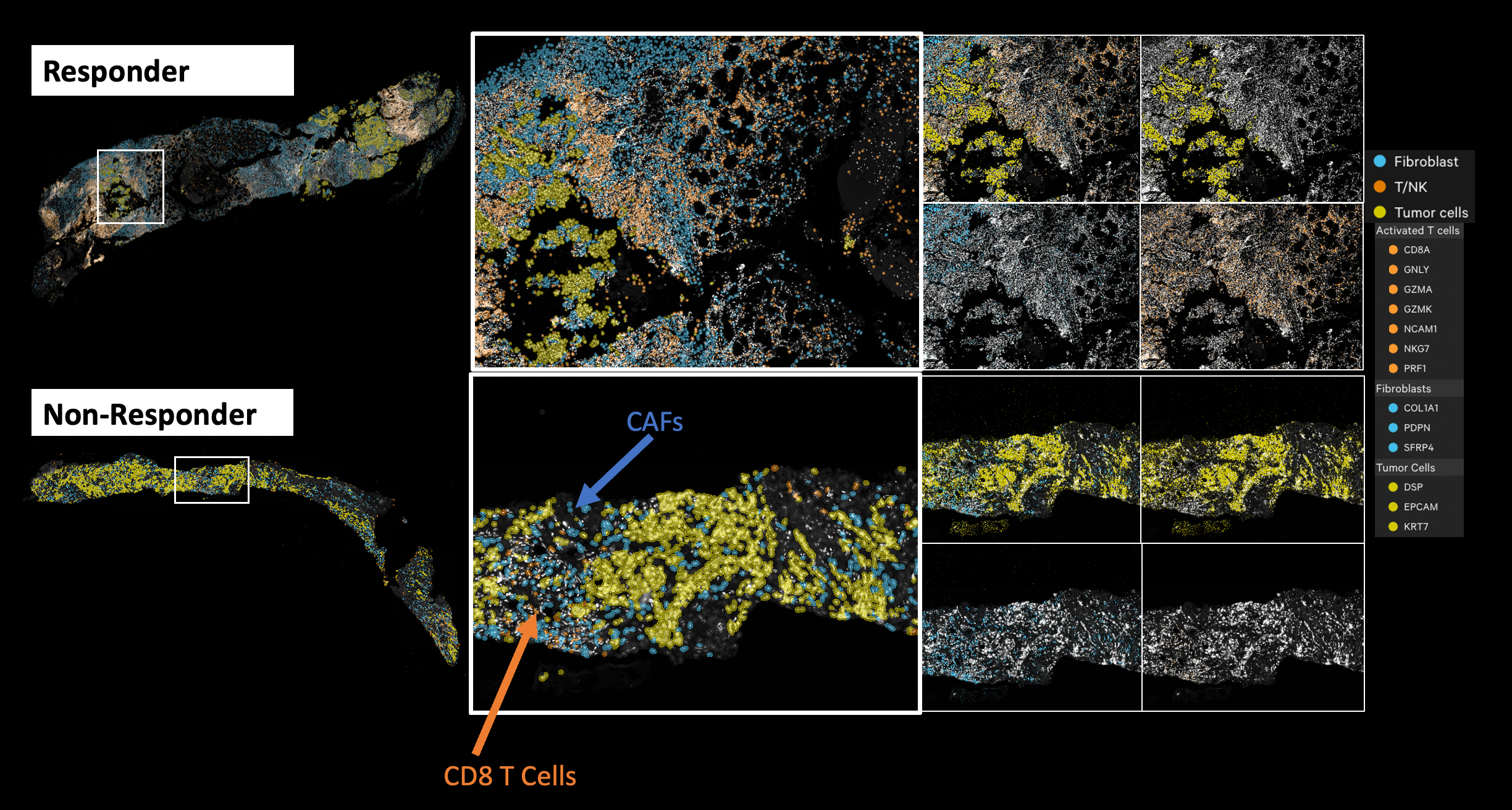 Xenium spatial transcriptomics