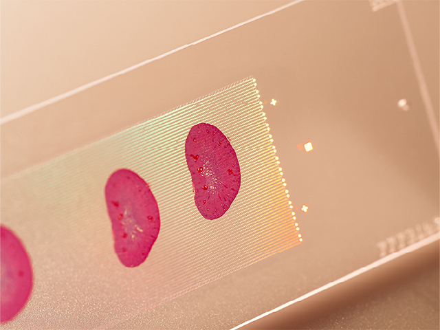 New reduced pricing for Illumina StrataMap